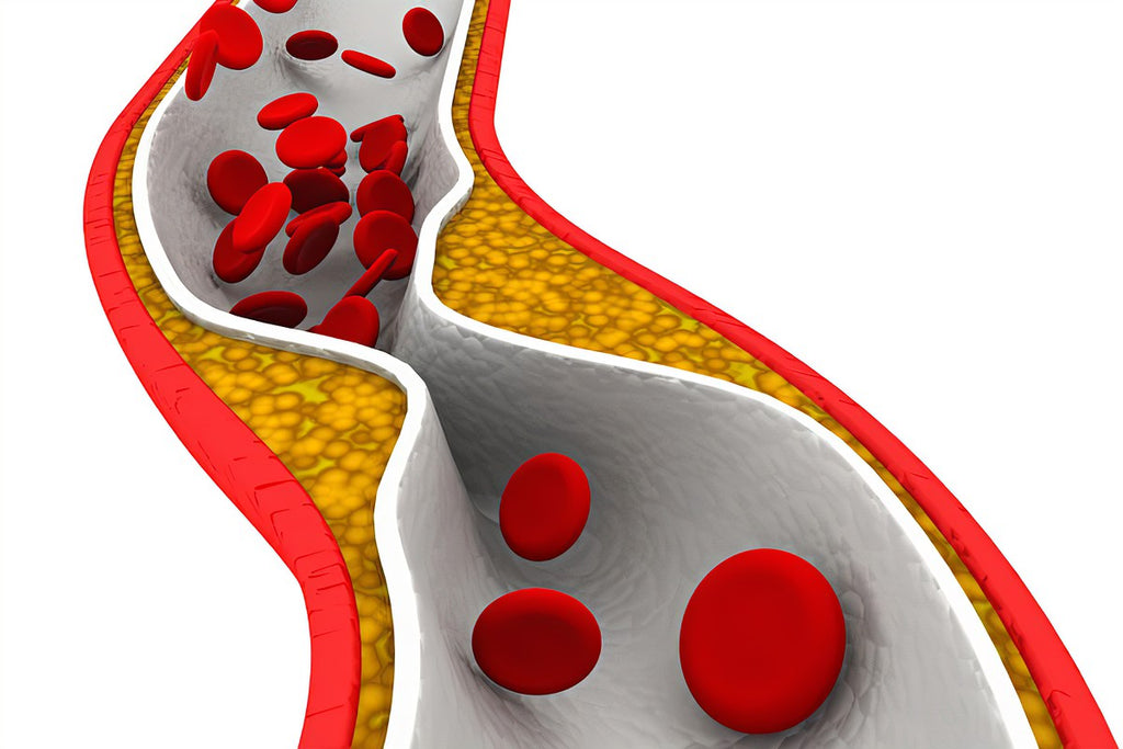 Causes of high cholesterol