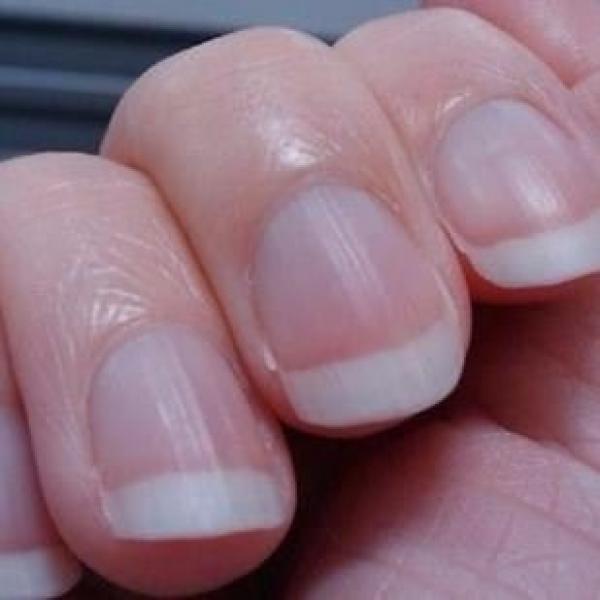 This wrinkle appears on the nails , the liver toxin has exploded